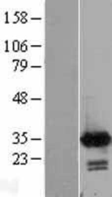 Western Blot Calretinin Overexpression Lysate