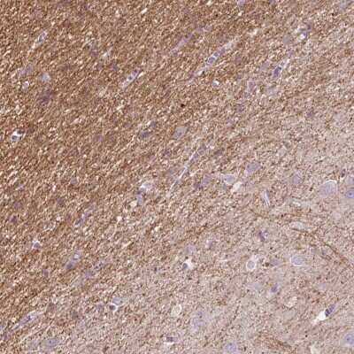Immunohistochemistry-Paraffin: Calsenilin Antibody [NBP2-57209] - Staining of human cerebral cortex shows cytoplasmic positivity in axonal projections.