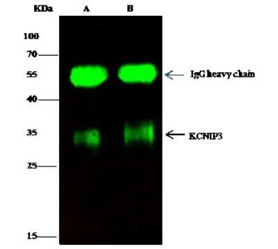 Immunoprecipitation: Calsenilin Antibody [NBP3-00359] - Calsenilin was immunoprecipitated using: Lane A: 0.5 mg MCF-7 Whole Cell Lysate. Lane B: 0.5 mg THP-1 Whole Cell Lysate. 0.5 ul anti-Calsenilin rabbit polyclonal antibody and 15 ul of 50 % Protein G agarose. Primary antibody: Anti-Calsenilin rabbit polyclonal antibody, at 1:350 dilution. Secondary antibody: Dylight 800-labeled antibody to rabbit IgG (H+L), at 1:5000 dilution. Developed using the Odyssey technique. Performed under reducing conditions. Predicted band size: 28 kDa. Observed band size: 35 kDa