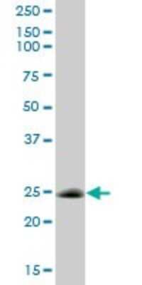 Western Blot: Calsenilin Antibody [H00030818-B01P] - Analysis of CSEN expression in rat brain.