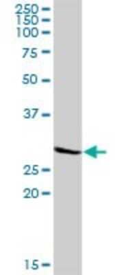 Western Blot: Calsenilin Antibody [H00030818-D01P] - Analysis of KCNIP3 expression in mouse liver.