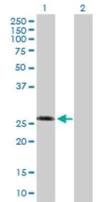 Western Blot: Calsenilin Antibody [H00030818-D01P] - Analysis of KCNIP3 expression in transfected 293T cell line by KCNIP3 polyclonal antibody.Lane 1: KCNIP3 transfected lysate(29.20 KDa).Lane 2: Non-transfected lysate.