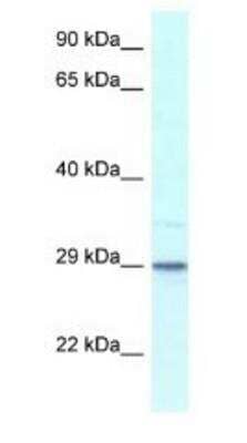 Western Blot: Calsenilin Antibody [NBP1-82380] - Calsenilin Antibody Mouse Pancreas Lysate 1.0 ug/ml, gel concentration 12%