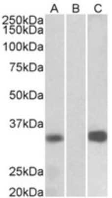 Western Blot Calsenilin Antibody