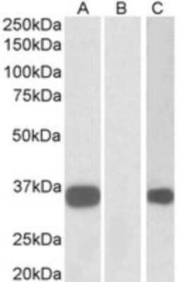 Western Blot Calsenilin Antibody