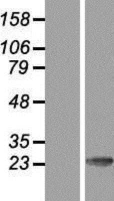 Western Blot Calsenilin Overexpression Lysate