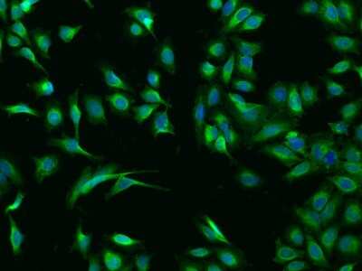 Immunocytochemistry/Immunofluorescence: Calsequestrin 1 Antibody [NBP3-00194] - Immunofluorescence staining of Calsequestrin 1 in HeLa cells. Cells were fixed with 4% PFA, permeabilzed with 0.1% Triton X-100 in PBS, blocked with 10% serum, and incubated with rabbit anti-Human Calsequestrin 1 polyclonal antibody (dilution ratio 1:200) at 4C overnight. Then cells were stained with the Alexa Fluor(R)488-conjugated Goat Anti-rabbit IgG Secondary antibody (green) and counterstained with DAPI (blue).Positive staining was localized to Cytoplasm.