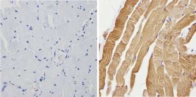 Immunohistochemistry-Paraffin: Calsequestrin 1 Antibody [NB120-3516] - Analysis showing positive staining in the cytoplasm of Human skeletal muscle (right) compared with a negative control in the absence of primary antibody (left).
