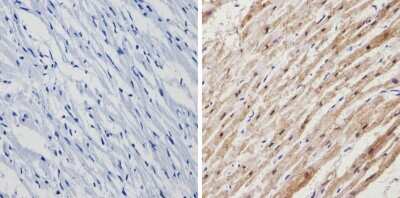 Immunohistochemistry-Paraffin: Calsequestrin 1 Antibody [NB120-3516] - Analysis showing positive staining in the cytoplasm of Human heart tissue (right) compared with a negative control in the absence of primary antibody (left).