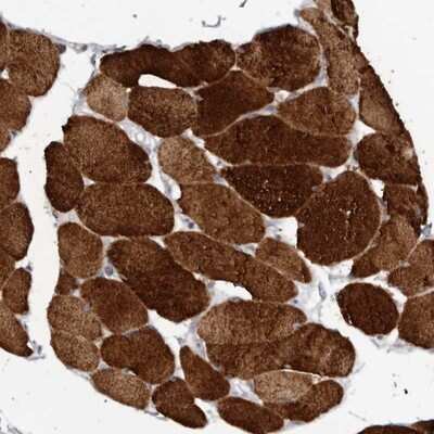 Immunohistochemistry-Paraffin: Calsequestrin 1 Antibody [NBP1-88180] - Staining of human skeletal muscle shows strong cytoplasmic positivity in myocytes.