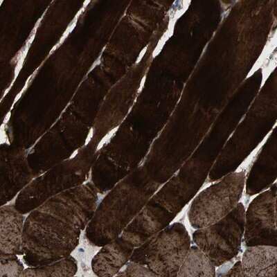 Immunohistochemistry-Paraffin: Calsequestrin 1 Antibody [NBP1-88181] - Staining of human skeletal muscle shows strong cytoplasmic positivity in myocytes.