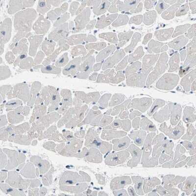 Immunohistochemistry-Paraffin: Calsequestrin 1 Antibody [NBP1-88181] - Staining of human heart muscle shows low expression as expected.