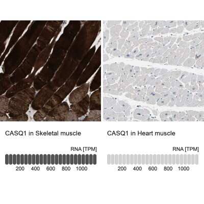 <b>Orthogonal Strategies Validation. </b>Immunohistochemistry-Paraffin: Calsequestrin 1 Antibody [NBP1-88181] - Staining in human skeletal muscle and heart muscle tissues using anti-CASQ1 antibody. Corresponding CASQ1 RNA-seq data are presented for the same tissues.