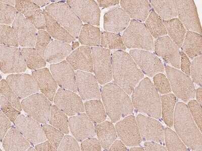 Immunohistochemistry-Paraffin: Calsequestrin 1 Antibody [NBP3-00194] - Immunochemical staining of Calsequestrin 1 in human skeletal muscle with rabbit polyclonal antibody at 1:300 dilution, formalin-fixed paraffin embedded sections.