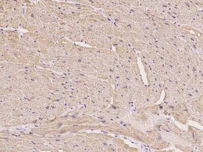 Immunohistochemistry-Paraffin: Calsequestrin 1 Antibody [NBP3-00194] - Immunochemical staining of Calsequestrin 1 in cynomolgus heart with rabbit polyclonal antibody at 1:300 dilution, formalin-fixed paraffin embedded sections.