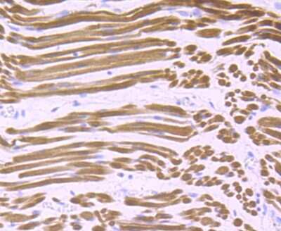 Immunohistochemistry-Paraffin: Calsequestrin 1 Antibody (JB57-37) [NBP2-75429] - Analysis of paraffin-embedded human fetal skeletal muscle tissue using anti-Calsequestrin 1 antibody. Counter stained with hematoxylin.