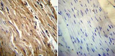 Immunohistochemistry-Paraffin: Calsequestrin 1 Antibody (VIIID12) [NB120-2824] - Both normal and cancer biopsies of deparaffinized Human heart tissue tissues.