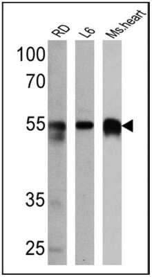 Western Blot: Calsequestrin 1 Antibody [NB120-3516] - Analysis of 25 ug of RD (Lane 1), L6 (Lane 2) and mouse heart (Lane 3) cell lysates.