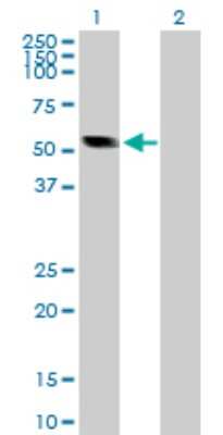 Western Blot: Calsequestrin 2 Antibody [H00000845-D01P] - Analysis of CASQ2 expression in transfected 293T cell line by CASQ2 polyclonal antibody.Lane 1: CASQ2 transfected lysate(46.40 KDa).Lane 2: Non-transfected lysate.