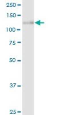 Western Blot: Calsyntenin-1 Antibody [H00022883-D01P] - Analysis of CLSTN1 expression in human kidney.