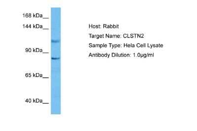 Western Blot: Calsyntenin-2 Antibody [NBP2-87119] - Host: Rabbit. Target Name: CLSTN2. Sample Tissue: Human Hela Whole Cell lysates. Antibody Dilution: 1ug/ml