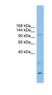 Western Blot: Calsyntenin-3 Antibody [NBP1-59713] - Titration: 0.2-1 ug/ml, Positive Control: RPMI 8226 cell lysate.