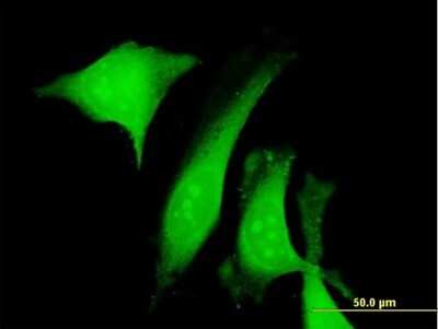 Immunocytochemistry/Immunofluorescence: Calumenin Antibody [H00000813-B01P] - Analysis of purified antibody to CALU on HeLa cell. (antibody concentration 10 ug/ml)