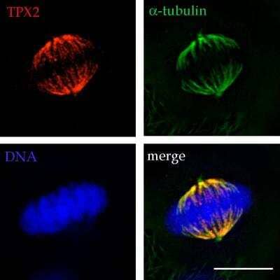 Immunocytochemistry/Immunofluorescence: Cancer Cell Development Antibody Pack [NBP1-78940] - Analysis of TPX2 using NB500-179 at the mitotic spindle microtubules and poles in a HeLa metaphase cell. Image from verified customer review.