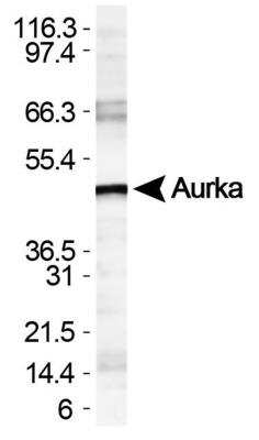 Western Blot: Cancer Cell Development Antibody Pack [NBP1-78940] - WB detection of Aurora A using NBP1-51843 in HeLa whole cell lysate.