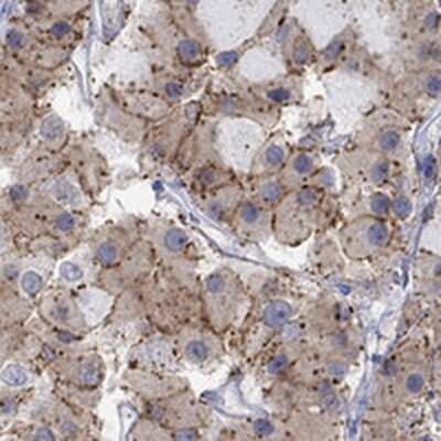 Immunohistochemistry-Paraffin: Cannabinoid R1/CB1/CNR1 Antibody [NBP3-17650] - Staining of human pituitary gland shows strong cytoplasmic positivity in anterior cells.