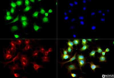 Immunocytochemistry/Immunofluorescence: Capicua Antibody [NB110-59905] - Capicua antibody was tested in Neuro 2A cells with DyLight 488 (green). Nuclei and alpha-tubulin were counterstained with DAPI (blue) and DyLight 550 (red).