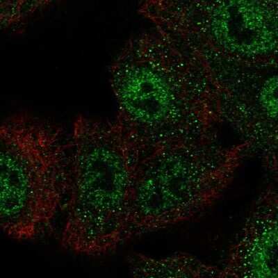 Immunocytochemistry/Immunofluorescence: Capicua Antibody [NBP2-56342] - Staining of human cell line A549 shows localization to nucleoplasm & vesicles.