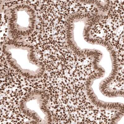 Immunohistochemistry-Paraffin: Capicua Antibody [NBP2-33420] - Staining of human endometrium shows moderate to strong nuclear positivity in glandular  stromal cells.