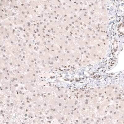 Immunohistochemistry-Paraffin: Capicua Antibody [NBP2-33420] - Staining of human liver shows very weak nuclear positivity in hepatocytes.