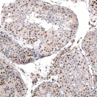 Immunohistochemistry-Paraffin: Capicua Antibody [NBP2-33420] - Staining of human testis shows moderate to strong nuclear positivity in cells in seminiferous ducts.