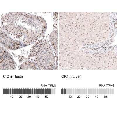 Immunohistochemistry-Paraffin: Capicua Antibody [NBP2-33420] - Staining in human testis and liver tissues . Corresponding CIC RNA-seq data are presented for the same tissues.