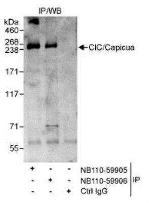 Immunoprecipitation: Capicua Antibody [NB110-59905] - Detection of Human CIC/Capicua by WB of IPs. Whole cell lysate from HeLa cells. Affinity purified rabbit NB110-59905 used for IP at 3  mcg/mg lysate. CIC was also IPed by rabbit anti-CICa antibody.