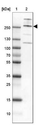 Western Blot: Capicua Antibody [NBP2-33420] - Lane 1: Marker [kDa] 250, 130, 100, 70, 55, 35, 25, 15, 10Lane 2: Human cell line A-549