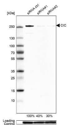 Western Blot: Capicua Antibody [NBP2-33420] - Analysis in A-549 cells transfected with control siRNA, target specific siRNA probe #1 and #2, using anti-CIC antibody. Remaining relative intensity is presented. Loading control: anti-GAPDH.