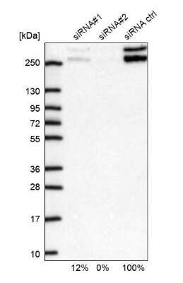 <b>Genetic Strategies Validation. </b>Western Blot: Capicua Antibody [NBP2-33420] - Analysis in U2OS cells transfected with control siRNA, target specific siRNA probe #1 and #2,. Remaining relative intensity is presented