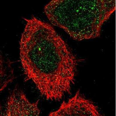 Immunocytochemistry/Immunofluorescence: Carbohydrate Sulfotransferase 15/CHST15 Antibody [NBP1-88367] - Staining of human cell line A-431 shows localization to cytosol & centrosome. Antibody staining is shown in green.