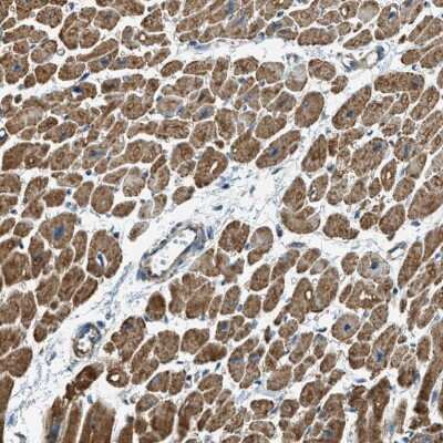 Immunohistochemistry-Paraffin: Carbohydrate Sulfotransferase 15/CHST15 Antibody [NBP1-88367] - Staining of human heart muscle shows strong positivity in myocytes.