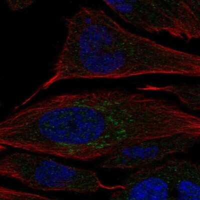 Immunocytochemistry/Immunofluorescence: Carbohydrate Sulfotransferase 2/CHST2 Antibody [NBP2-55604] - Staining of human cell line PC-3 shows localization to the Golgi apparatus.