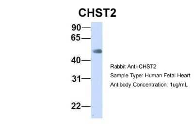 Western Blot: Carbohydrate Sulfotransferase 2/CHST2 Antibody [NBP1-59944] - Human Fetal Heart, Antibody Dilution: 1.0 ug/ml.