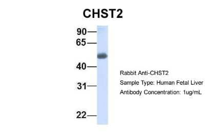 Western Blot: Carbohydrate Sulfotransferase 2/CHST2 Antibody [NBP1-59944] - Human Fetal Liver, Antibody Dilution: 1.0 ug/ml.