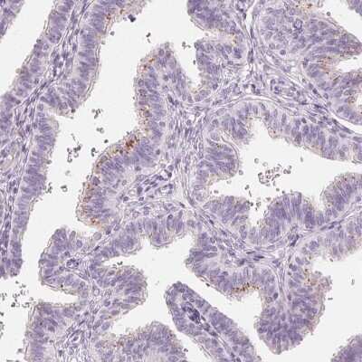 Immunohistochemistry-Paraffin: Carbohydrate Sulfotransferase 4/CHST4 Antibody [NBP1-91748] - Staining of human fallopian tube shows positivity in glandular cells.