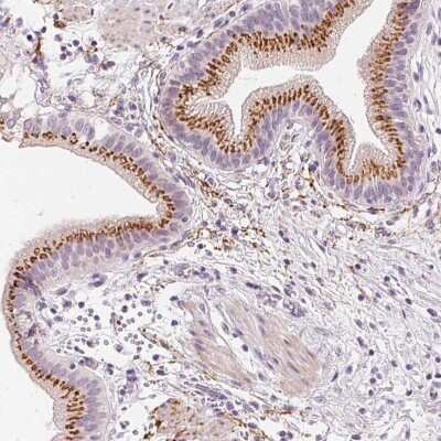 Immunohistochemistry-Paraffin: Carbohydrate Sulfotransferase 4/CHST4 Antibody [NBP1-91748] - Staining of human gallbladder shows positivity in glandular cells.