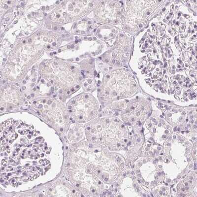 Immunohistochemistry-Paraffin: Carbohydrate Sulfotransferase 4/CHST4 Antibody [NBP1-91748] - Staining of human kidney shows no positivity as expected.