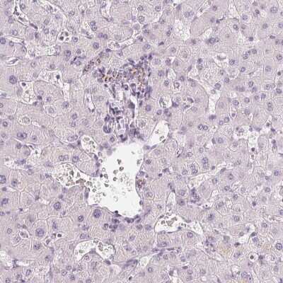 <b>Orthogonal Strategies Validation. </b>Immunohistochemistry-Paraffin: Carbohydrate Sulfotransferase 4/CHST4 Antibody [NBP1-91748] - Staining of human liver shows positivity in bile duct cells.