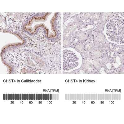 Immunohistochemistry-Paraffin: Carbohydrate Sulfotransferase 4/CHST4 Antibody [NBP1-91748] - Staining in human gallbladder and kidney tissues . Corresponding CHST4 RNA-seq data are presented for the same tissues.